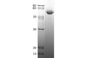 Validation with Western Blot (FETUB Protein (His tag))