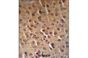 PFTK1 Antibody (N-term P82) (RB18842) IHC analysis in formalin fixed and paraffin embedded human brain tissue followed by peroxidase conjugation of the secondary antibody and DAB staining. (CDK14 Antikörper  (N-Term))