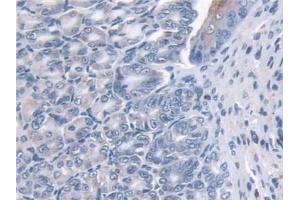 Immunohistochemistry (IHC) image for anti-Glutaredoxin 1 (GRX1) (AA 2-107) antibody (ABIN7441412)