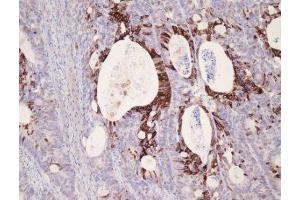 Immunohistochemistry (IHC) image for anti-Keratin 25 (KRT25) (C-Term) antibody (ABIN870621) (Keratin 25 Antikörper  (C-Term))