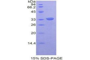 SDS-PAGE (SDS) image for V-Rel Reticuloendotheliosis Viral Oncogene Homolog B (RELB) (AA 176-436) protein (His tag) (ABIN1877878)