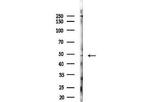 anti-WD Repeat Domain, Phosphoinositide Interacting 2 (WIPI2) (pSer413) antibody