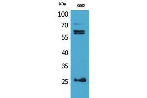 Western Blotting (WB) image for anti-Protein C Receptor, Endothelial (PROCR) (Internal Region) antibody (ABIN3178317) (PROCR Antikörper  (Internal Region))