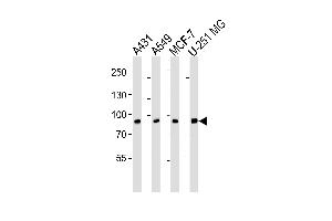 Western blot analysis of lysates from A431, A549, MCF-7, U-251 MG cell line (from left to right), using CN1 Antibody (ABIN6242895 and ABIN6577068). (CAPNL1 Antikörper  (AA 1-420))