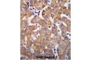 ANKRD58 Antibody (C-term) immunohistochemistry analysis in formalin fixed and paraffin embedded human liver tissue followed by peroxidase conjugation of the secondary antibody and DAB staining. (ANKRD58 Antikörper  (C-Term))