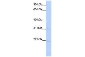 WB Suggested Anti-SLC25A21 Antibody Titration:  0. (SLC25A21 Antikörper  (N-Term))