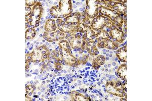 Immunohistochemistry of paraffin-embedded Mouse kidney using GATM antibody at dilution of 1:100 (x400 lens).