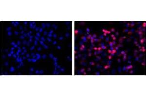 LEFT: untransfected control, RIGHT: anti-His (in red) on His-tagged fusion proteins in HEK293 cells.