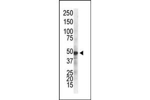 The anti-IKKgamma Mab (ABIN387828 and ABIN2843912) is used in Western blot to detect IKKgamma in ZR75-1 cell lysate.