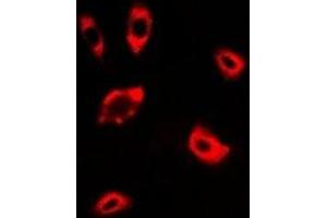 Immunofluorescent analysis of DPP8 staining in A549 cells.