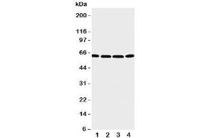 Western blot testing of P2X6 antibody and Lane 1:  U87;  2: 22RV1;  3: Jurkat;  4: HT1080 cell lysate. (P2RX6 Antikörper  (C-Term))