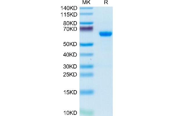 ADAM8 Protein (AA 17-655) (His tag)