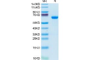 ADAM8 Protein (AA 17-655) (His tag)