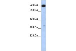 WB Suggested Anti-PTF1A Antibody Titration:  0. (PTF1A Antikörper  (N-Term))