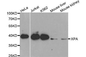 Western blot analysis of extracts of various cell lines, using XPA antibody. (XPA Antikörper)
