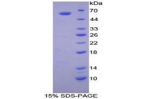 SDS-PAGE analysis of Dog Cathepsin K Protein.