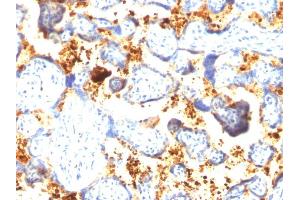Formalin-fixed, paraffin-embedded human Placenta stained with Transglutaminase II Mouse Monoclonal Antibody (SPM358). (Transglutaminase 2 Antikörper)