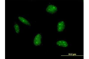 Immunofluorescence of purified MaxPab antibody to EXO1 on HeLa cell. (Exonuclease 1 Antikörper  (AA 1-846))