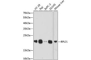 Western blot analysis of extracts of various cell lines, using RPL21 antibody (ABIN7269996) at 1:1000 dilution. (RPL21 Antikörper  (AA 1-160))