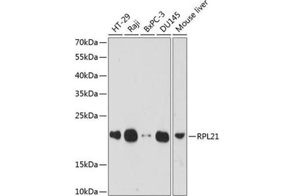 RPL21 anticorps  (AA 1-160)