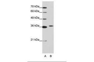 Image no. 1 for anti-Exosome Component 7 (EXOSC7) (AA 71-120) antibody (ABIN202173) (EXOSC7 Antikörper  (AA 71-120))