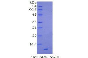 SDS-PAGE (SDS) image for Chemokine (C-C Motif) Ligand 20 (CCL20) (AA 24-97) protein (His tag) (ABIN2121586)