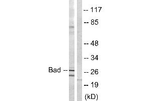 Immunohistochemistry analysis of paraffin-embedded human brain tissue using BAD (Ab-134) antibody. (BAD Antikörper)