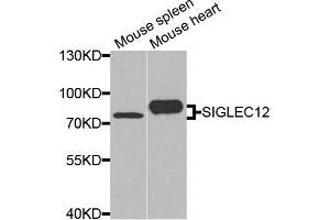 Western blot analysis of extracts of mouse spleen and mouse heart cells, using SIGLEC12 antibody. (SIGLEC12 Antikörper)