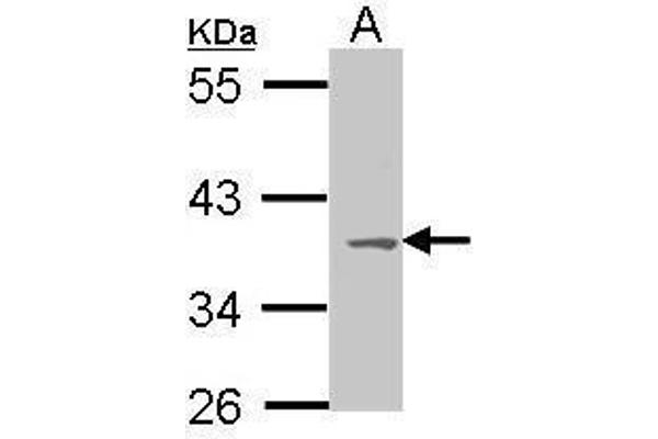 MC1 Receptor Antikörper  (C-Term)