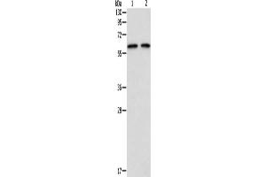 Gel: 8 % SDS-PAGE, Lysate: 40 μg, Lane 1-2: 293T cells, hela cells, Primary antibody: ABIN7128229(ADAM2 Antibody) at dilution 1/300, Secondary antibody: Goat anti rabbit IgG at 1/8000 dilution, Exposure time: 15 seconds (ADAM2 Antikörper)