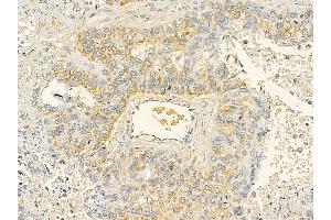 anti-Glutamate Receptor, Ionotropic, Kainate 4 (GRIK4) antibody
