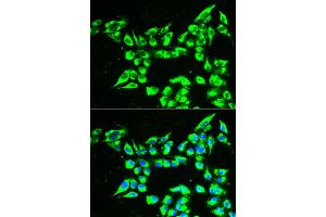 Immunofluorescence analysis of A549 cells using KLK10 antibody (ABIN6290548). (Kallikrein 10 Antikörper)