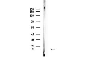 anti-Lipopolysaccharide-Induced Tumor Necrosis Factor-alpha Factor (LITAF) (Internal Region) antibody