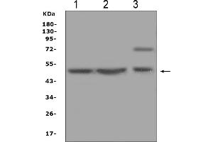 Western blot analysis of AP2M1 using anti-AP2M1 antibody (ABIN4886462).