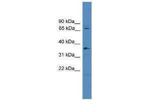 Western Blot showing SF4 antibody used at a concentration of 1-2 ug/ml to detect its target protein. (Splicing Factor 4 Antikörper  (C-Term))