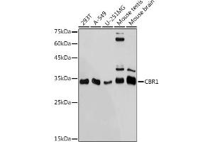 Western blot analysis of extracts of various cell lines, using CBR1 antibody (ABIN7266076) at 1:1000 dilution. (CBR1 Antikörper)