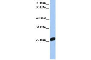 Western Blotting (WB) image for anti-Coagulation Factor X (F10) antibody (ABIN2458605) (Coagulation Factor X Antikörper)