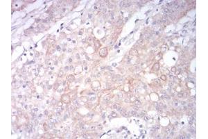 Immunohistochemistry (IHC) image for anti-Low Density Lipoprotein Receptor-Related Protein 1 (LRP1) (AA 20-155) antibody (ABIN5897030) (LRP1 Antikörper  (AA 20-155))