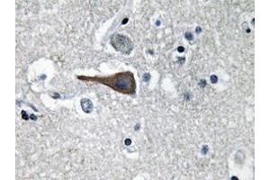 Immunohistochemistry analyzes of CCK antibody in paraffin-embedded human brain tissue. (Cholecystokinin Antikörper)