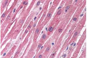 anti-Tuberous Sclerosis 1 (TSC1) (C-Term) antibody