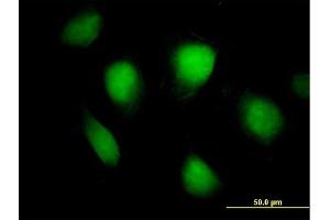 Immunofluorescence of purified MaxPab antibody to FHL1 on HeLa cell. (FHL1 Antikörper  (AA 1-280))