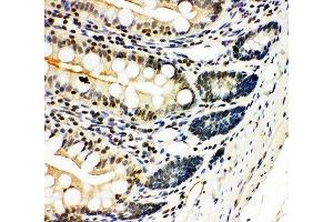 IHC-P: NFKB2 antibody testing of rat intestine tissue (NFKB2 Antikörper  (N-Term))