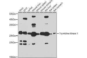 Western blot analysis of extracts of various cell lines, using Thymidine Kinase 1 antibody (ABIN6132726, ABIN6149198, ABIN6149199 and ABIN6221245) at 1:1000 dilution.