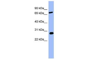 WB Suggested Anti-COMT Antibody Titration:  0.