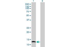 Western Blotting (WB) image for anti-Nuclear Factor of Activated T-Cells, Cytoplasmic, Calcineurin-Dependent 2 Interacting Protein (NFATC2IP) (AA 1-138) antibody (ABIN529819)
