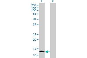 Western Blot analysis of NFATC2IP expression in transfected 293T cell line by NFATC2IP MaxPab polyclonal antibody. (NFATC2IP Antikörper  (AA 1-138))