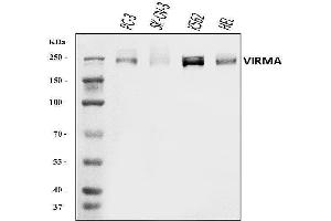 Western blot analysis of KI/VIRMA using anti-KI/VIRMA antibody (ABIN7599707). (Protein Virilizer Homolog (VIRMA) (AA 11-1529) Antikörper)