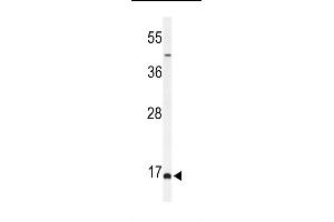 Western Blotting (WB) image for anti-Biorientation of Chromosomes in Cell Division 1 (BOD1) (AA 127-155), (C-Term) antibody (ABIN653927)