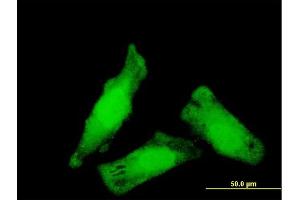 Immunofluorescence of monoclonal antibody to NIPBL on HeLa cell. (NIPBL Antikörper  (AA 66-175))