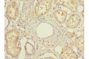 Immunohistochemistry of paraffin-embedded human kidney tissue using ABIN7159418 at dilution of 1:100 (MIER2 Antikörper  (AA 1-545))